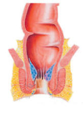 early symptoms of piles in female