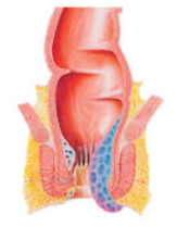 early symptoms of piles in female