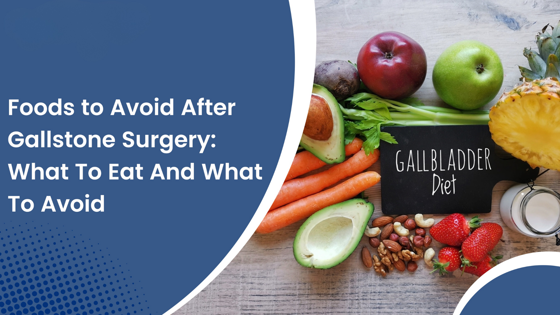Foods to Avoid After Gallbladder Removal – What Doctors Recommend